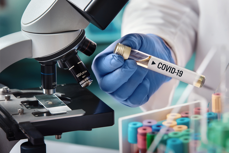 laborstudie cannabinoide und covid 19 virus_1644424099
